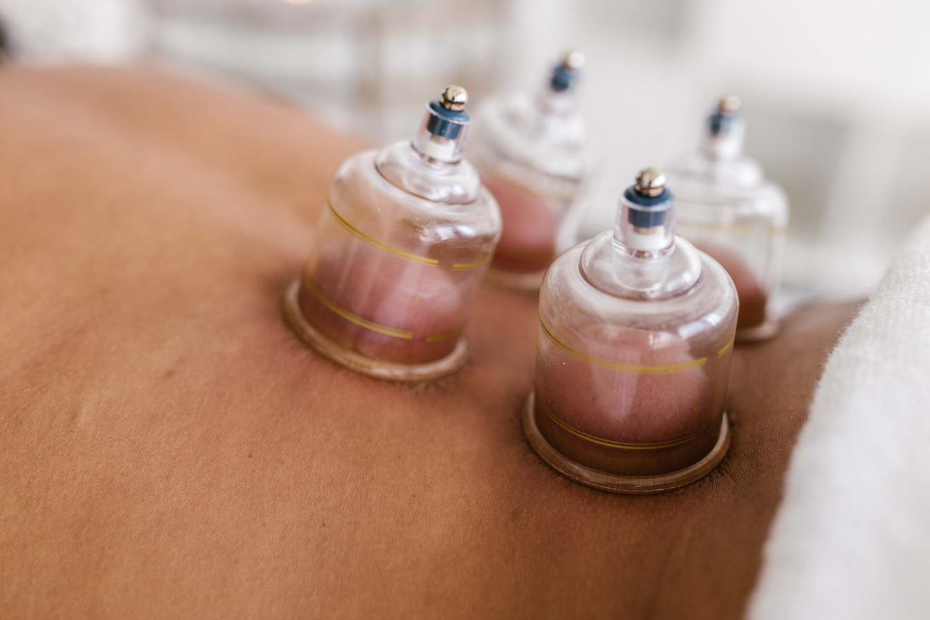 Close Up Shot of a Cupping Therapy
